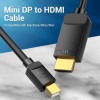 Vention mini DisplayPort to HDMI 1.5m Black (HAHBG) - зображення 4